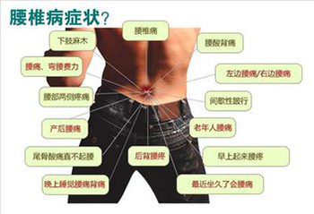 教你如何用老艾堂古方理疗治疗腰间盘突出
