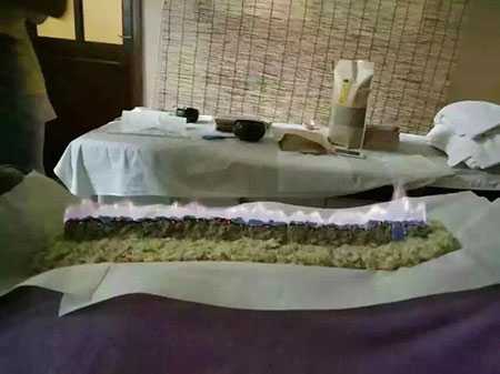 强直性脊柱炎患者请注意 老艾堂三伏灸疗法龙虎灸能够有效治愈