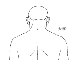 中医艾灸馆加盟必学【扁桃体发炎灸法】