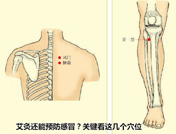 艾灸还能预防感冒？关键看这几个穴位